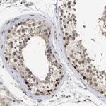 NLE1 Antibody in Immunohistochemistry (Paraffin) (IHC (P))