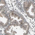 SLC43A1 Antibody in Immunohistochemistry (Paraffin) (IHC (P))