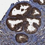 FNTA Antibody in Immunohistochemistry (Paraffin) (IHC (P))