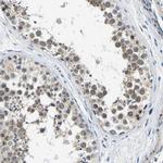 LIAS Antibody in Immunohistochemistry (Paraffin) (IHC (P))