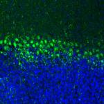 LIAS Antibody in Immunohistochemistry (Paraffin) (IHC (P))