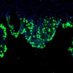 LIAS Antibody in Immunohistochemistry (Paraffin) (IHC (P))