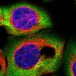 CSDE1 Antibody in Immunocytochemistry (ICC/IF)