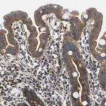 CSDE1 Antibody in Immunohistochemistry (Paraffin) (IHC (P))