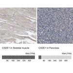 CSDE1 Antibody in Immunohistochemistry (IHC)