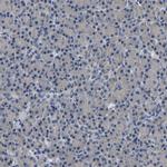 CSDE1 Antibody in Immunohistochemistry (IHC)