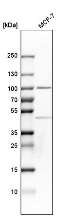 CSDE1 Antibody in Western Blot (WB)