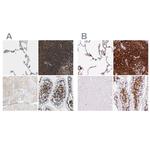 EVL Antibody in Immunohistochemistry (IHC)