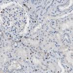 EVL Antibody in Immunohistochemistry (IHC)