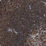 EVL Antibody in Immunohistochemistry (IHC)