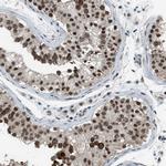 KPNA6 Antibody in Immunohistochemistry (IHC)