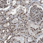 KPNA6 Antibody in Immunohistochemistry (IHC)