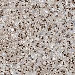 KPNA6 Antibody in Immunohistochemistry (IHC)