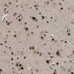 KPNA6 Antibody in Immunohistochemistry (IHC)