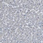 KPNA6 Antibody in Immunohistochemistry (IHC)