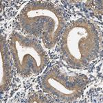 PPP2R1B Antibody in Immunohistochemistry (Paraffin) (IHC (P))