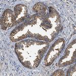 PPP2R1B Antibody in Immunohistochemistry (Paraffin) (IHC (P))