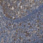 PPP2R1B Antibody in Immunohistochemistry (Paraffin) (IHC (P))