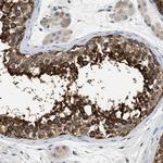 PPP2R1B Antibody in Immunohistochemistry (IHC)