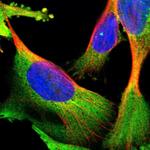 YARS Antibody in Immunocytochemistry (ICC/IF)