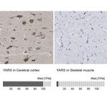 YARS Antibody