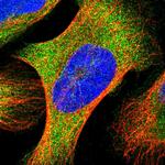 YARS Antibody in Immunocytochemistry (ICC/IF)