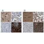 YARS Antibody in Immunohistochemistry (IHC)