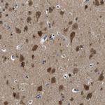 YARS Antibody in Immunohistochemistry (IHC)