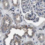 YARS Antibody in Immunohistochemistry (IHC)