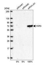 YARS Antibody in Western Blot (WB)