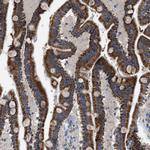 SLC25A13 Antibody in Immunohistochemistry (Paraffin) (IHC (P))