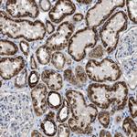 SLC25A13 Antibody in Immunohistochemistry (Paraffin) (IHC (P))