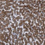 SLC25A13 Antibody in Immunohistochemistry (Paraffin) (IHC (P))