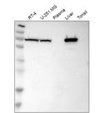 SLC25A13 Antibody in Western Blot (WB)