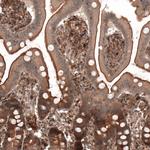 IL17RE Antibody in Immunohistochemistry (Paraffin) (IHC (P))