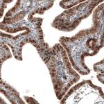 IL17RE Antibody in Immunohistochemistry (Paraffin) (IHC (P))