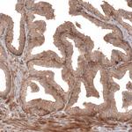 IL17RE Antibody in Immunohistochemistry (Paraffin) (IHC (P))