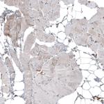 IL17RE Antibody in Immunohistochemistry (Paraffin) (IHC (P))