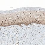 TET1 Antibody in Immunohistochemistry (IHC)