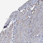 COBL Antibody in Immunohistochemistry (IHC)