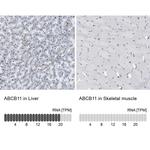 ABCB11 Antibody in Immunohistochemistry (IHC)