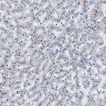 ABCB11 Antibody in Immunohistochemistry (IHC)