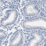 ABCB11 Antibody in Immunohistochemistry (Paraffin) (IHC (P))