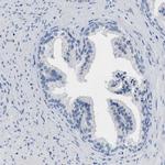 ABCB11 Antibody in Immunohistochemistry (Paraffin) (IHC (P))