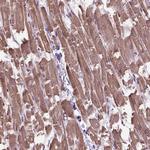 XK Antibody in Immunohistochemistry (IHC)