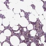 XK Antibody in Immunohistochemistry (IHC)