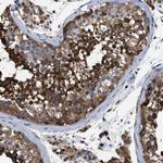 OR10S1 Antibody in Immunohistochemistry (Paraffin) (IHC (P))