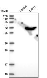 CROT Antibody in Western Blot (WB)