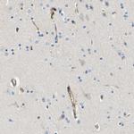 AHNAK Antibody in Immunohistochemistry (Paraffin) (IHC (P))