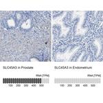 Prostein Antibody in Immunohistochemistry (IHC)